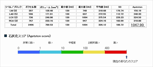 カルシウムスコア