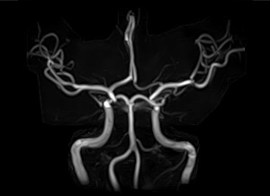 宇都宮記念病院のMRI・MRA検査の画像