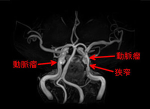 宇都宮記念病院のMRI・MRA検査の画像