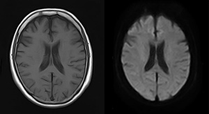 宇都宮記念病院のMRI・MRA検査の画像