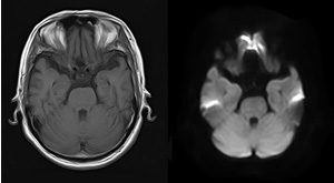 宇都宮記念病院のMRI・MRA検査の画像