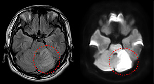 宇都宮記念病院のMRI・MRA検査の画像