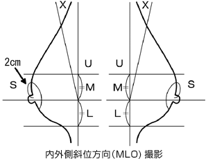 宇都宮記念病院の乳房X線（マンモグラフィ）検査