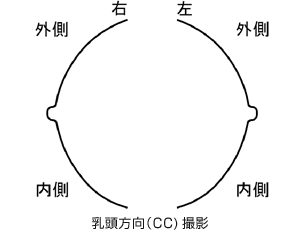 宇都宮記念病院の乳房X線（マンモグラフィ）検査