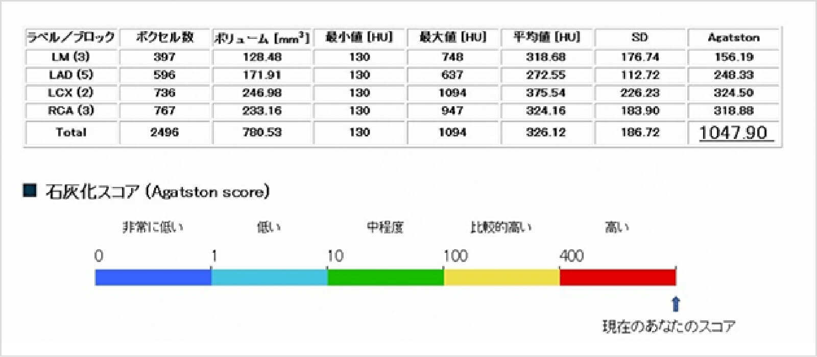カルシウムスコア測定