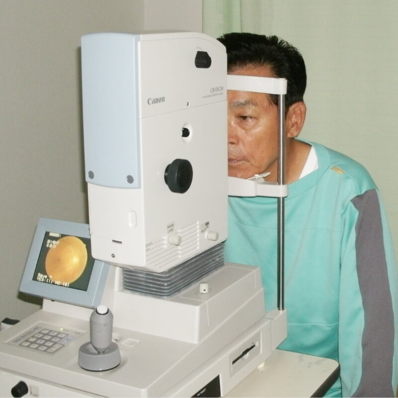 眼底検査