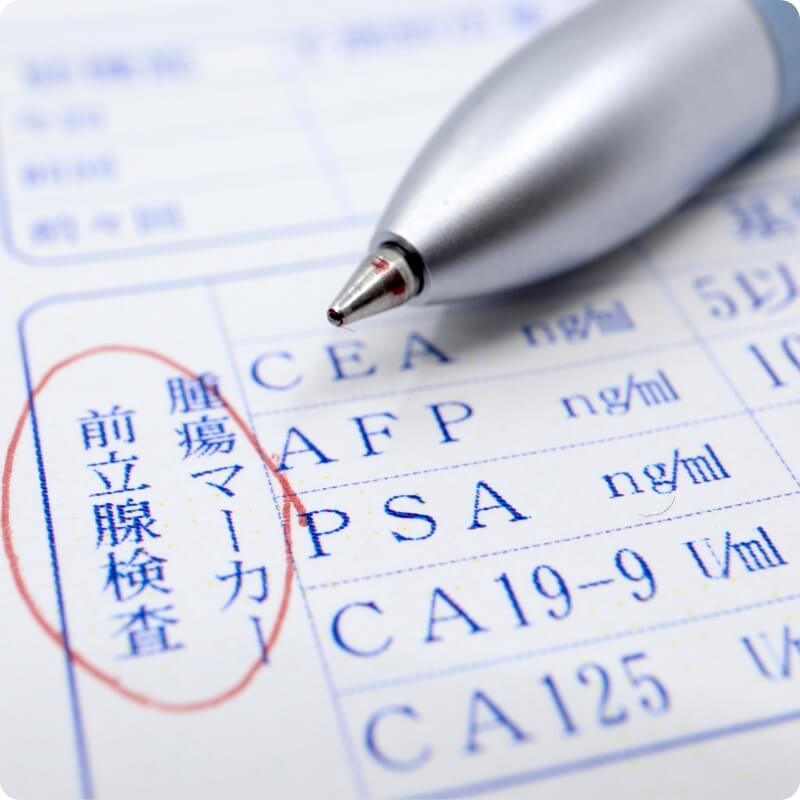 PSA検査