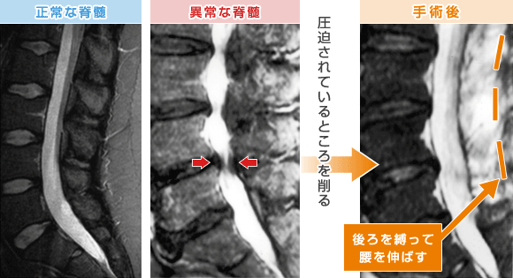 宇都宮記念病院で腰部椎間板ヘルニアなどの治療