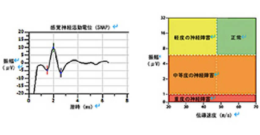 簡易型感覚神経伝導検査DPNチェック2