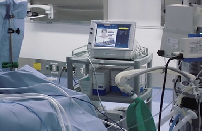 術中モニタリング装置2