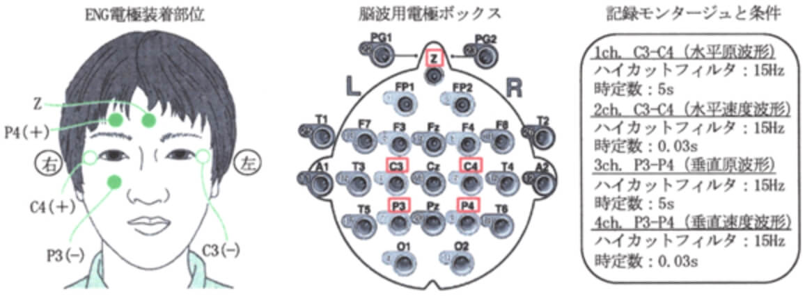 脳波計における電気眼振図(ENG)の記録
