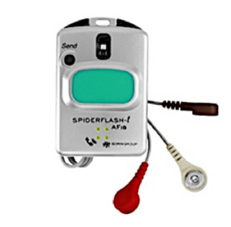 体外式イベントループレコーダーとは