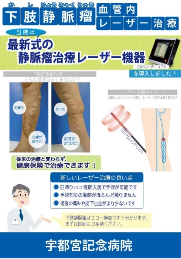 下肢静脈瘤血管内レーザー治療